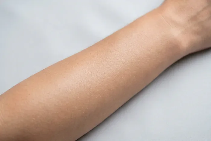 Peau propre et saine après le retrait du stencil de tatouage