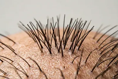 Vue rapprochée et minimaliste du cuir chevelu pour illustrer la santé capillaire.