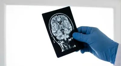 Gros plan minimaliste d'un examen IRM pour la sclérose en plaques.