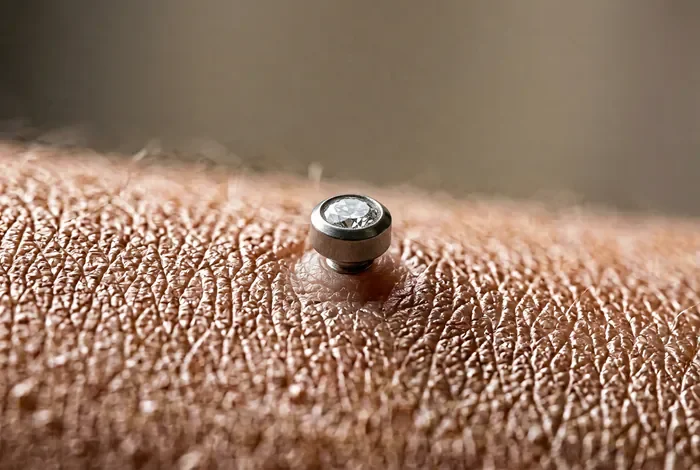 Rejet microdermal : causes, symptômes et soins à adopter Vue rapprochée d'un implant microdermal