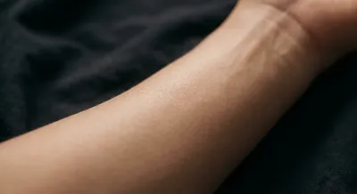 Gros plan iconique sur une peau saine et apaisée après un traitement.